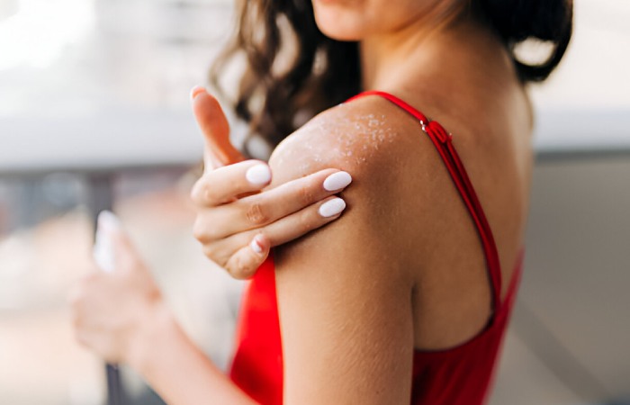 I Have Dry Skin – Like, Really Dry Skin