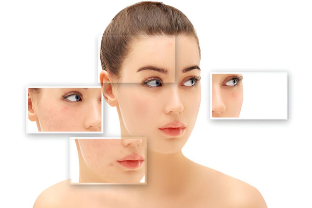 Clean Girl Aesthetic: Everything You Need to Know in 2025 Clean Girl Aesthetic